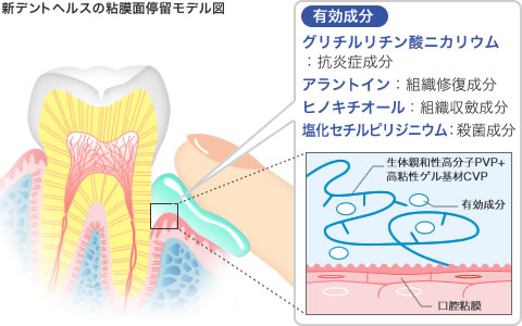 新デントヘルスの粘膜面停留モデル図